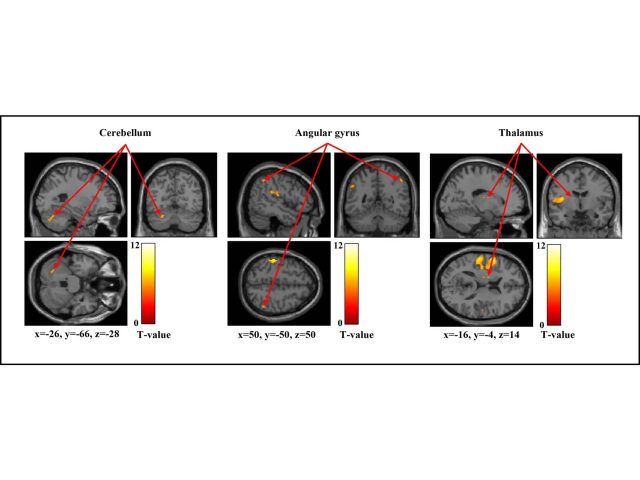 強さの異なる機械的刺激に対して脳がどのように反応するかをまとめた図